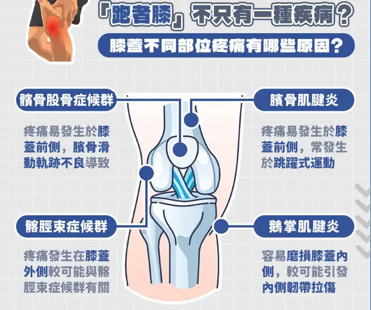跑者膝對職業球員的影響分析